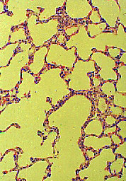 Anat normal lung histo