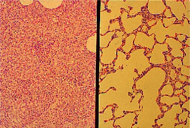 描述: 描述: PRRS histology + normal